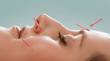 Image for Cosmetic Acupuncture Treatment